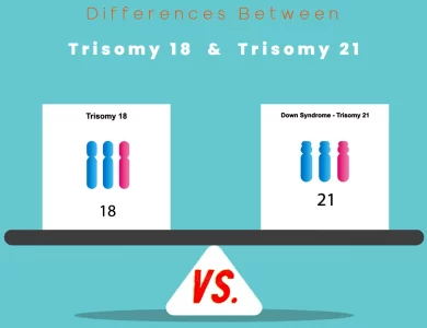 Differences Between Trisomy 18 vs 21