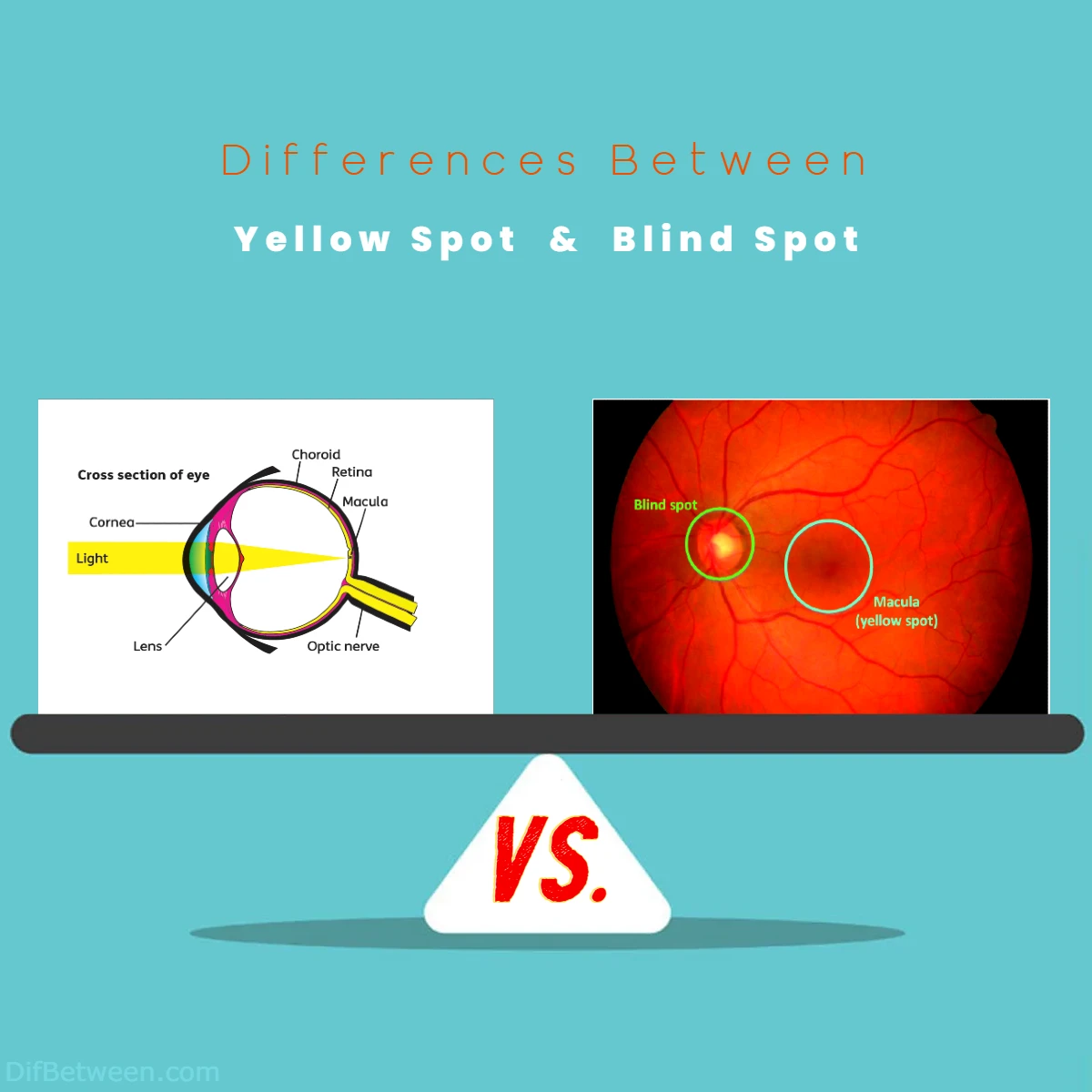 Differences Between Yellow Spot vs Blind Spot